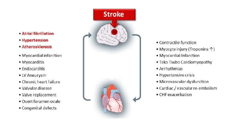 Stroke As Interdisciplinary Disease What The Practising Cardiologist Can Do